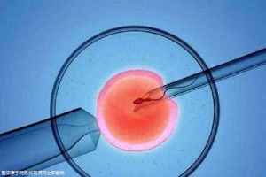 试管代生包性别门诊